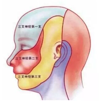 脑血栓用经颅磁刺激仪能治好吗