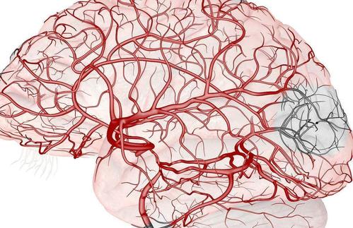 导致脑供血不足的原因